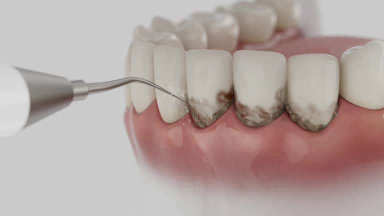 Reliable Dental Implants contractor in Colfax, LA by Smile Center Dentistry